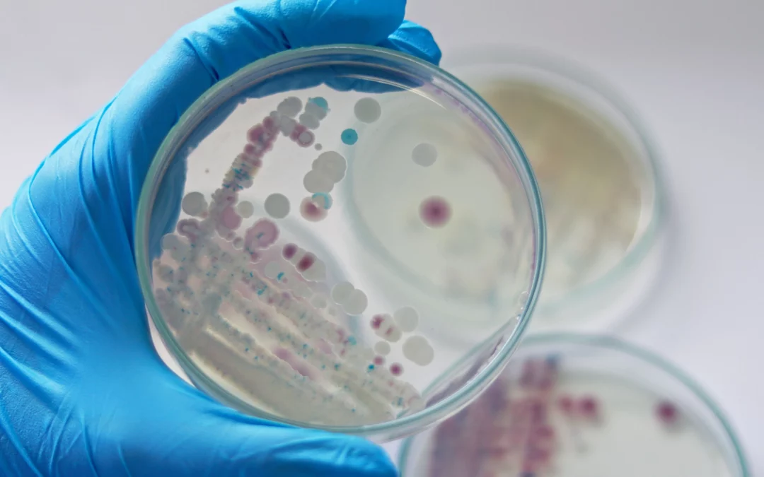 Varias víctimas mortales en EE.UU. por bacteria «comecarne»