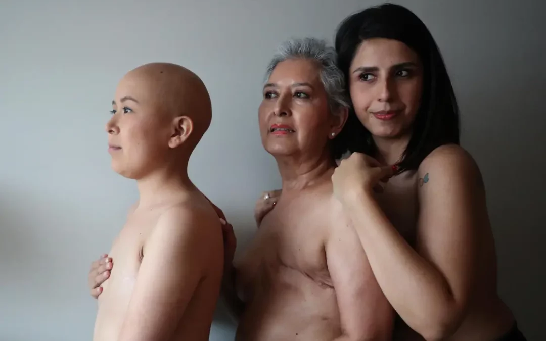 Una de cada 12 mujeres en el mundo desarrollará cáncer de mama