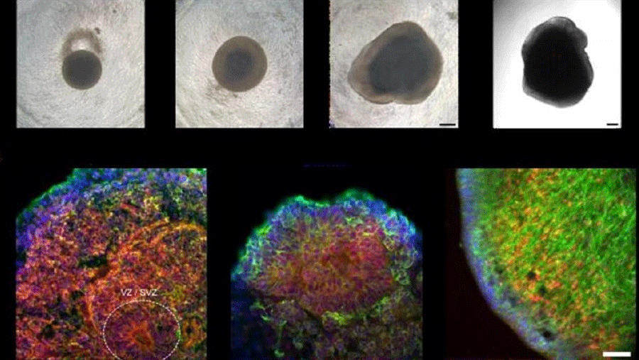 ¡CON IA! Construyen una computadora con tejido cerebral humano