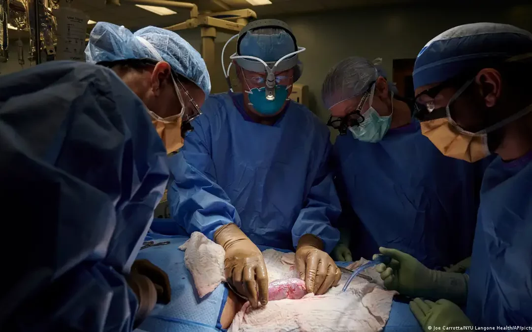 Utilizan por primera vez un hígado de cerdo para filtrar sangre humana